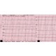 PAPIER pour ELECTROCARDIOGRAPHE EDAN SE-601C-EDA047